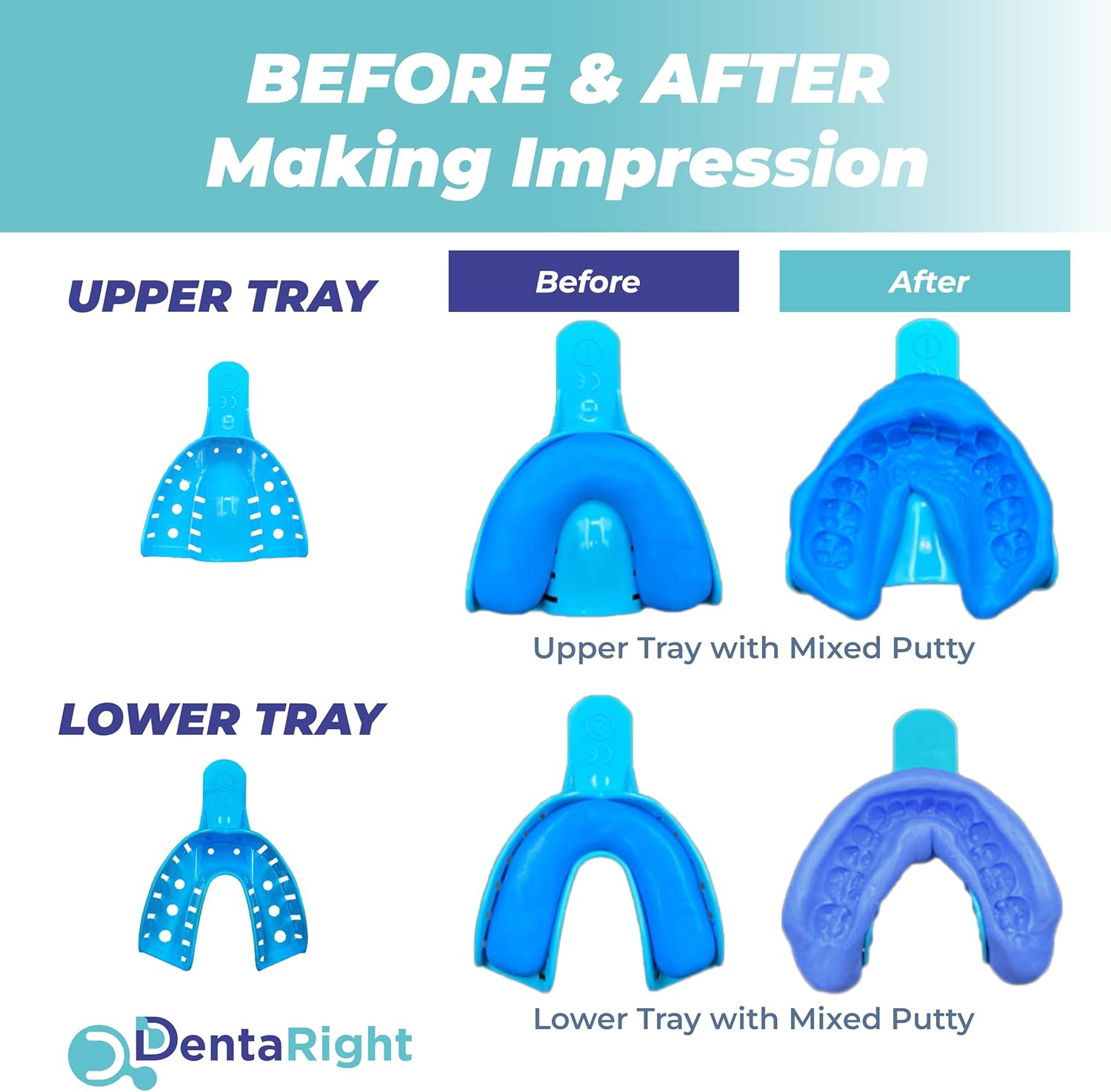 Homemade Teeth Guard Custom Dental Molding Kit - Make Your Own Mouth Guard for Teeth Grindi ...
